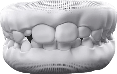 Adult & Baby Teeth Mixed